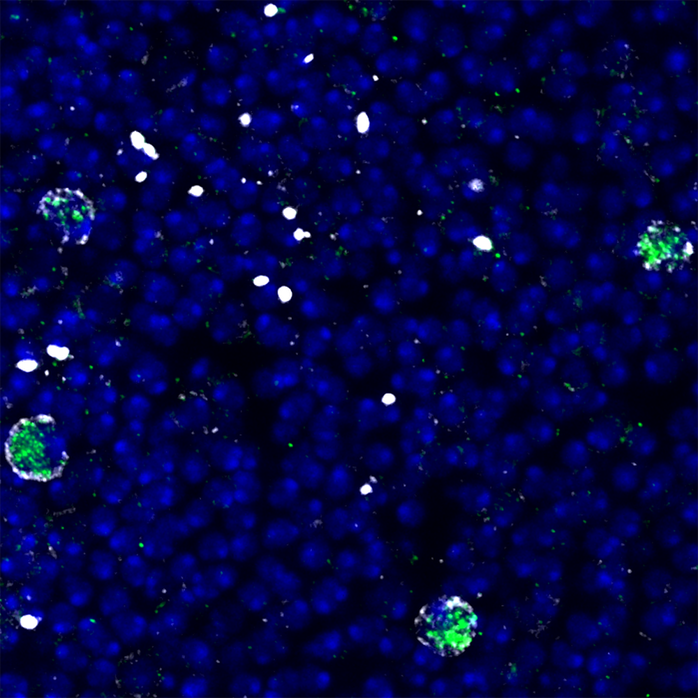 Scientists Reveal How Brain Injury Activates Neural Stem Cells Scientists Reveal How Brain Injury Activates Neural Stem Cells